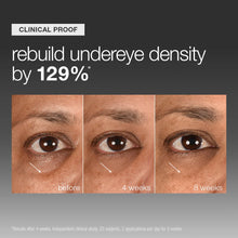 Load image into Gallery viewer, Smart Eye Density Under Eye Serum