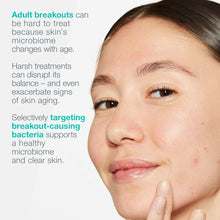 Load image into Gallery viewer, Breakout Biotic Moisturizer

